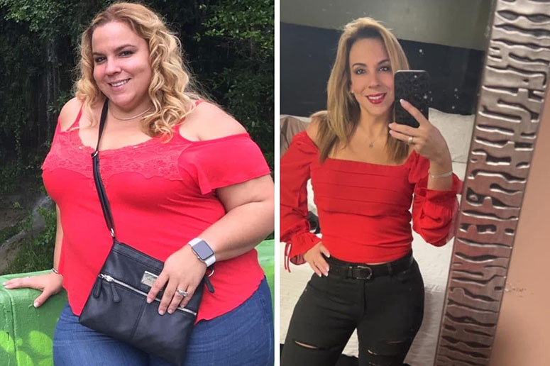 A photo showing Elizabeth before and after