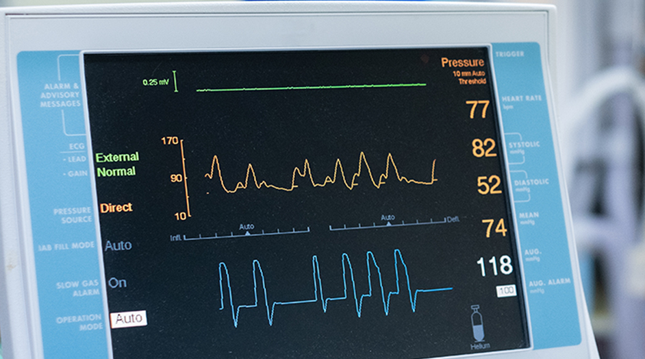cardiac monitoring machine
