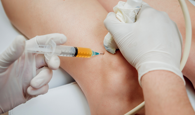 applying platelet-rich plasma treatment injection in knee